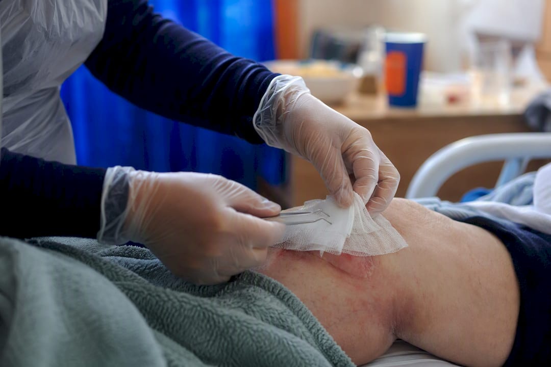 Hands performing clinical wound care procedure